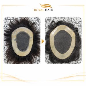 Base Hair System And Wig Repair & Reconstruction