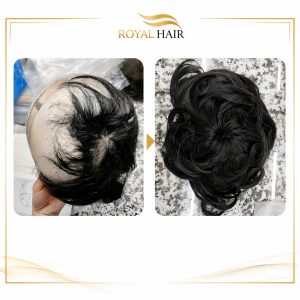 Hair Color And Density Repair For Wig, Topper & Toupee
