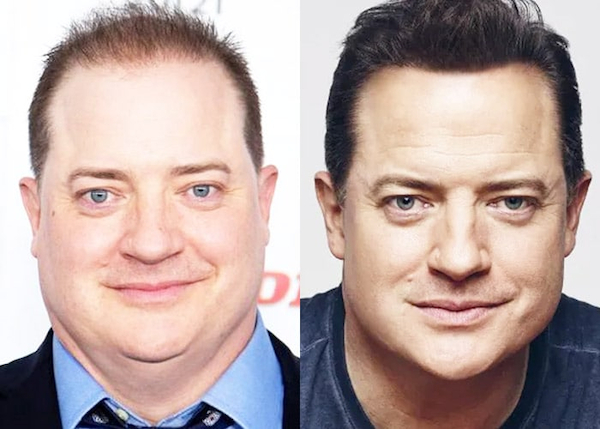 Brendan Fraser