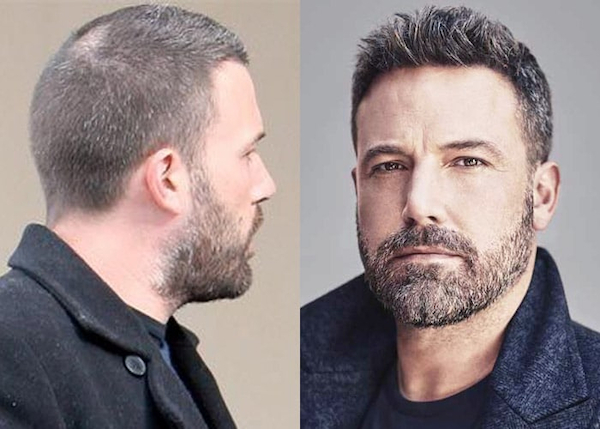 Ben Affleck