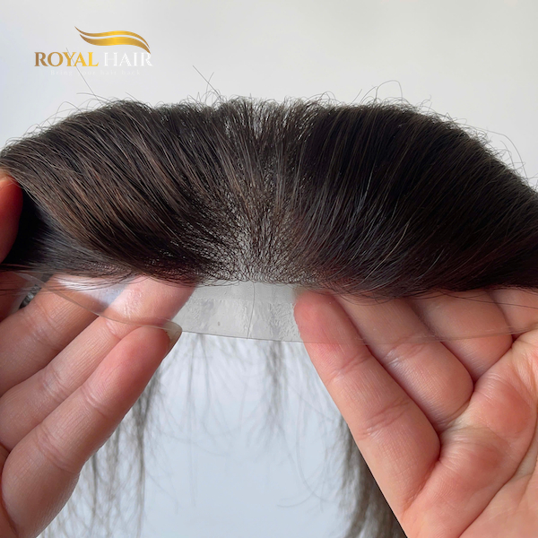 Hair Patch at Royal Hair