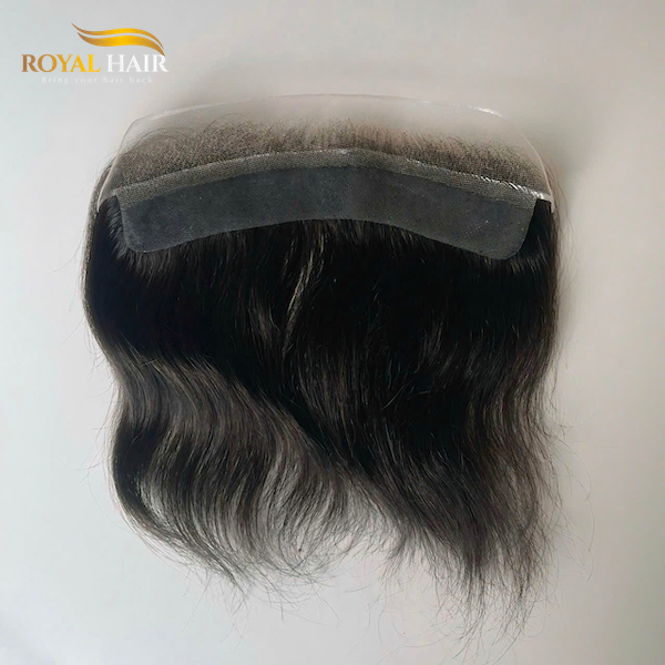 Who Should Consider Getting a Hair Patch?