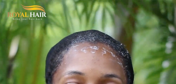 How to deal with leftover wig glue after removal
