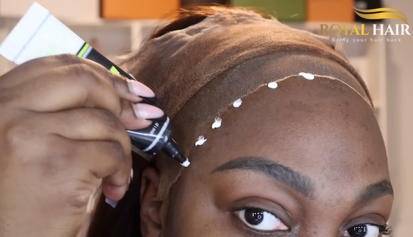 Apply the skin adhesive